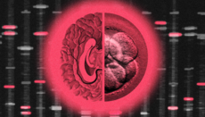 In Silicon Valley, high-IQ 