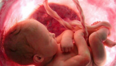 Avortul a devenit principala cauză de deces în lume în anul 2025, – statistici OMS