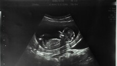 Στη Βρετανία καταγράφηκε ρεκόρ αριθμού αμβλώσεων σε όλη την ιστορία των παρατηρήσεων