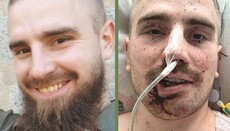 На Буковине просят молитв за тяжело раненного сына священника УПЦ