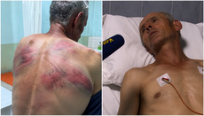 Serbian Church Demands Response to Beating of Parishioner in Kosovo